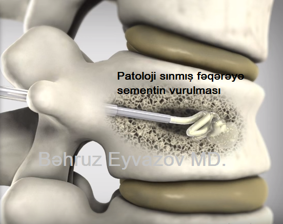 Tukli porno voyeurizm